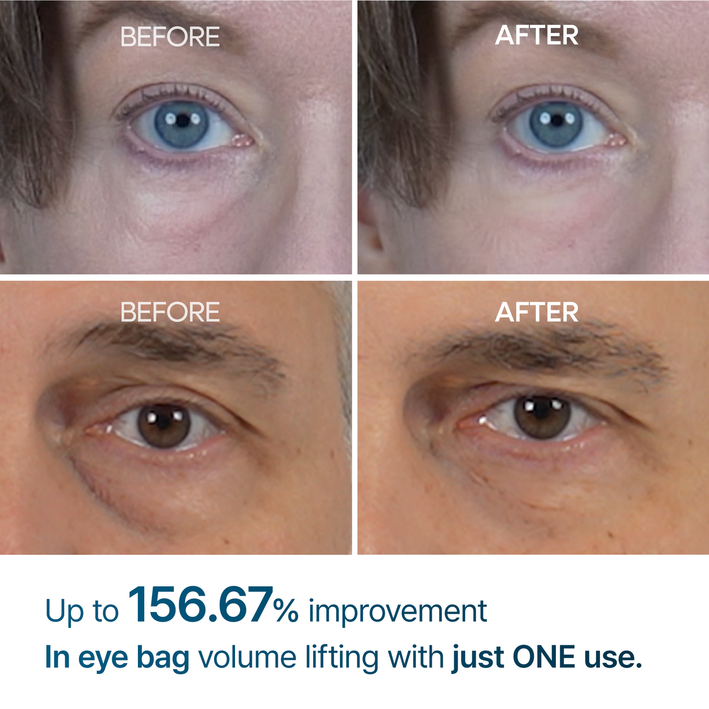 Bestseller | Eyephalt eyebag cream