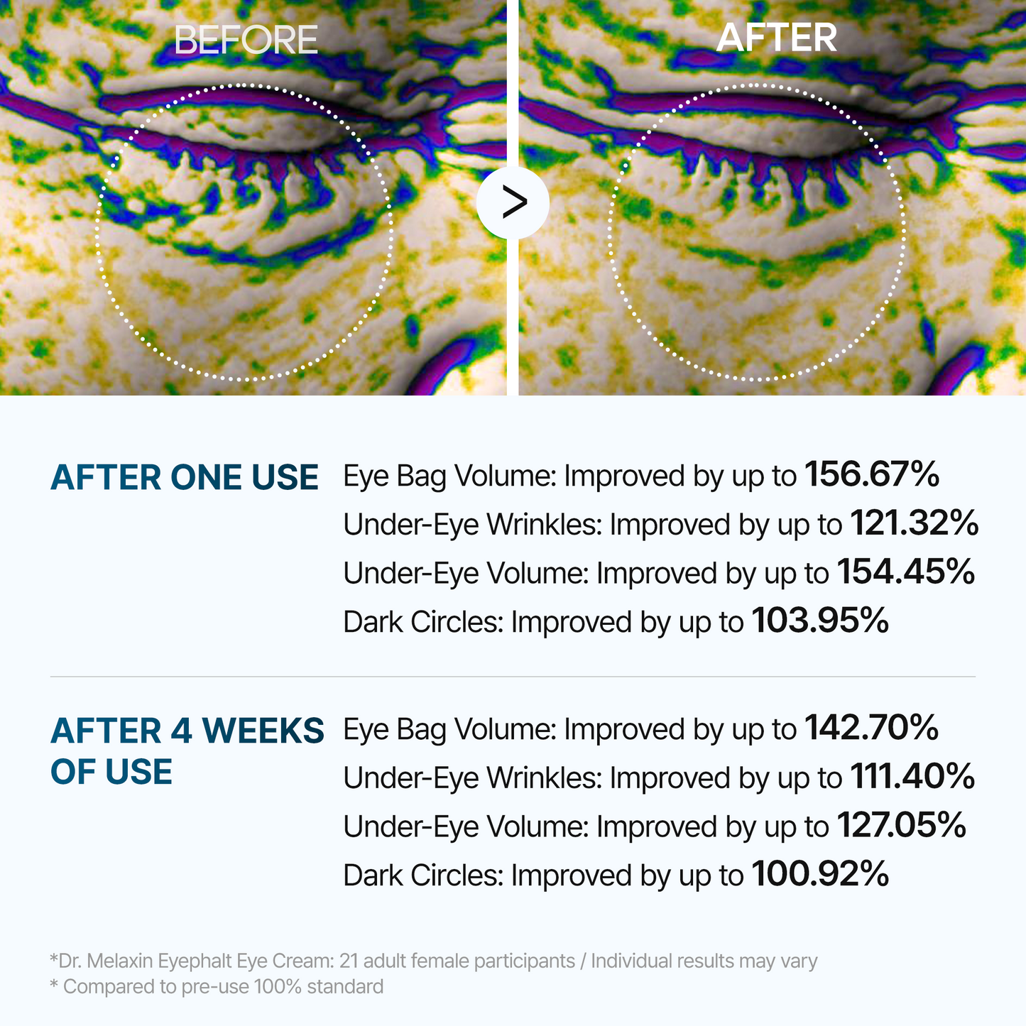 Bestseller | Eyephalt eyebag cream