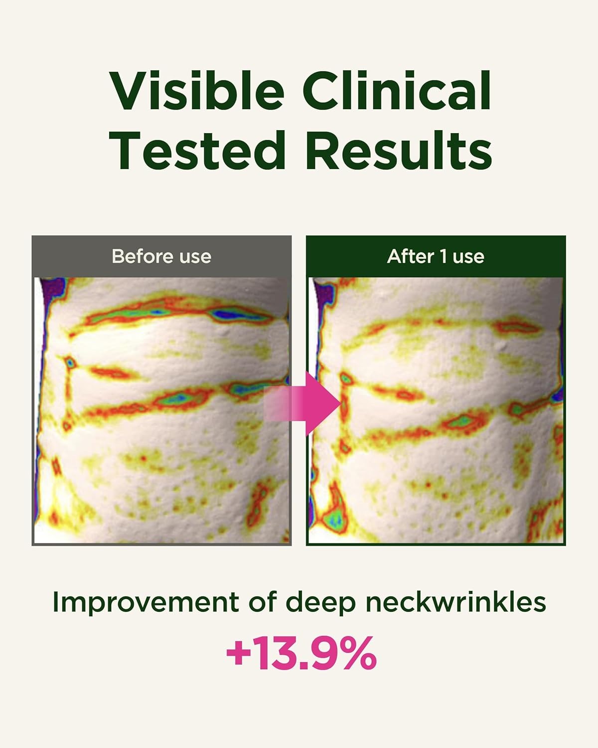 CKD Retinal Collagen Intensive Cream — Reduce Fine Lines, Brighten Dark Spots & Deep Hydration